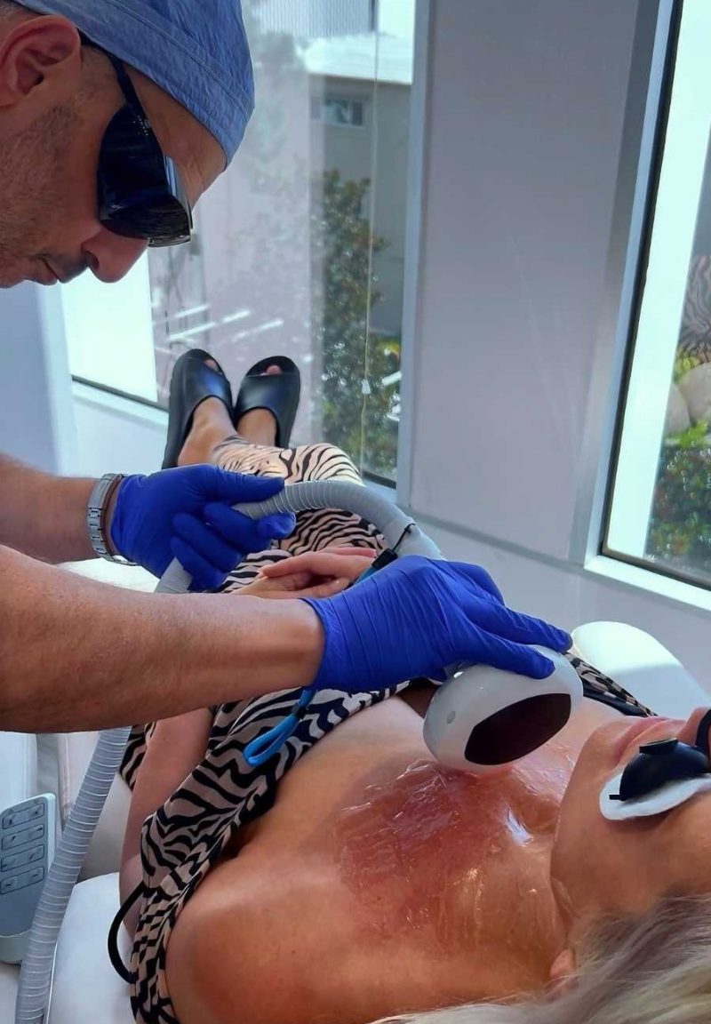 Board Certified MD, Dr. Behnoush Zarrini, performing Lumecca IPL treatment on the chest, with a patient lying comfortably as the device glides across the skin.