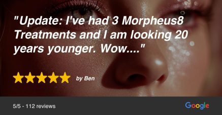 Google image review for Morpheus8 treatment in Beverly Hills