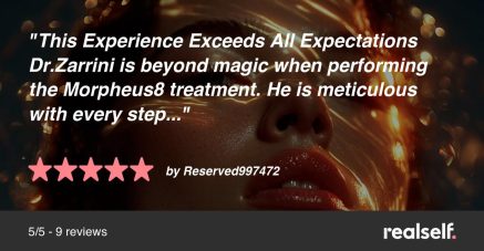 RealSelf image review for Morpheus8 treatment in Beverly Hills